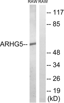 Oncogene TIM rabbit pAb Antibody