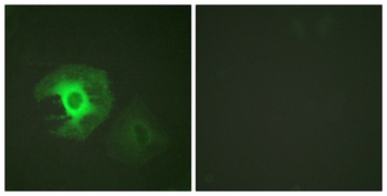 Caldesmon rabbit pAb Antibody
