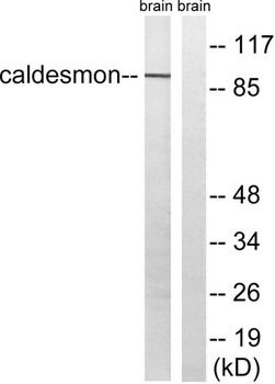 Caldesmon rabbit pAb Antibody
