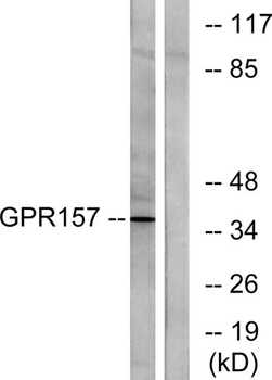 GPR157 rabbit pAb Antibody