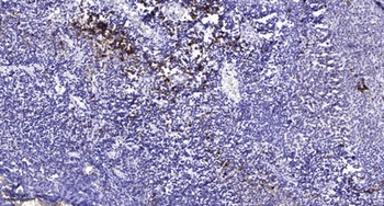 Cubilin rabbit pAb Antibody