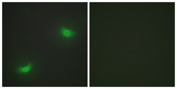 MKP-7 rabbit pAb Antibody