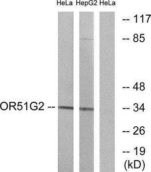 Olfactory receptor 51G2 rabbit pAb Antibody