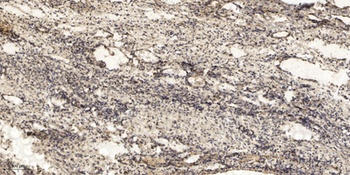 PSGR rabbit pAb Antibody