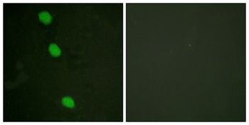 CaMKIV (phospho Thr200) rabbit pAb