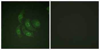 CaMKIV rabbit pAb Antibody