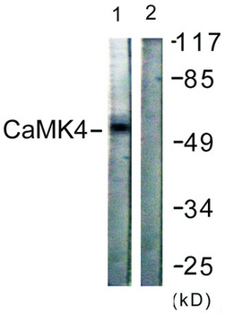 CaMKIV rabbit pAb Antibody