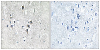 CaMKIIα/δ rabbit pAb Antibody