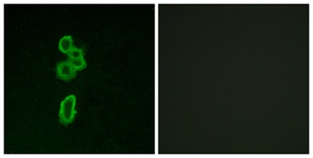 Frizzled-6 rabbit pAb Antibody
