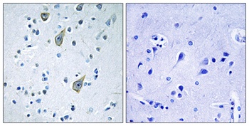 Frizzled-6 rabbit pAb Antibody