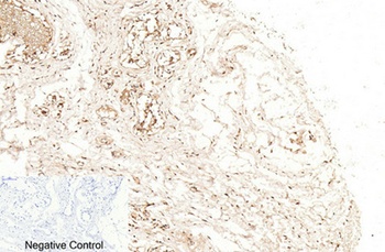 Cleaved-Caspase-1 p20 (D210) rabbit pAb