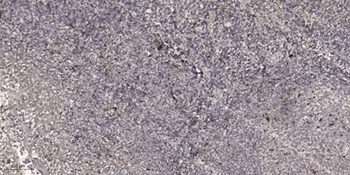 ADP-GK rabbit pAb Antibody
