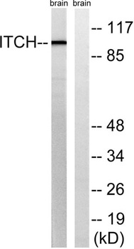 AIP4 rabbit pAb Antibody