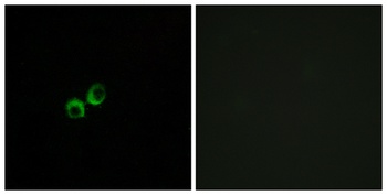 T1R3 rabbit pAb Antibody