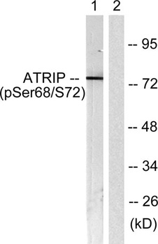 ATRIP (phospho Ser68) rabbit pAb
