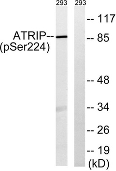 ATRIP (phospho Ser224) rabbit pAb Antibody