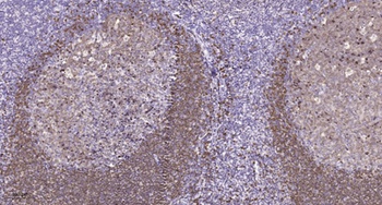RPA135 rabbit pAb Antibody