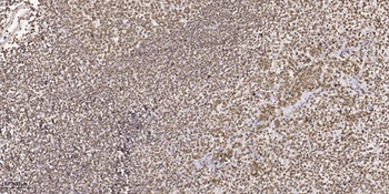 Maf1 rabbit pAb Antibody