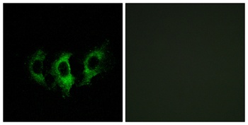 EF-G2 rabbit pAb Antibody