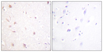 NIFK rabbit pAb Antibody