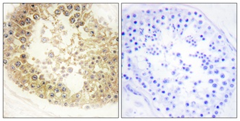 ECRG4 rabbit pAb Antibody