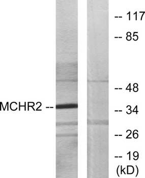 MCH-2R rabbit pAb