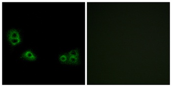 TMEM185A rabbit pAb Antibody