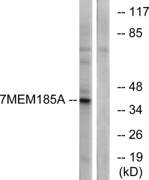 TMEM185A rabbit pAb Antibody