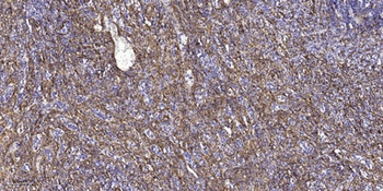 TMEM185A rabbit pAb Antibody