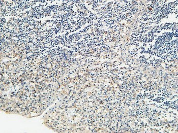 KiSS-1R rabbit pAb Antibody