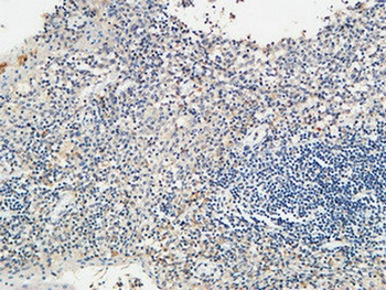 KiSS-1R rabbit pAb Antibody