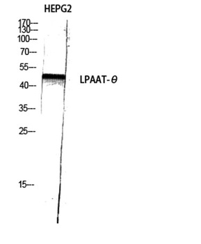 LPAAT-θ rabbit pAb Antibody