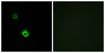 GALR3 rabbit pAb Antibody