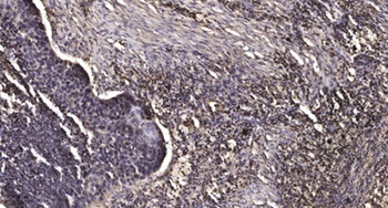 MMP-23 rabbit pAb Antibody