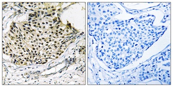 IKKγ (phospho Ser31) rabbit pAb
