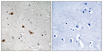 IKKγ (phospho Ser376) rabbit pAb Antibody