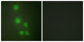 BAF53 rabbit pAb Antibody