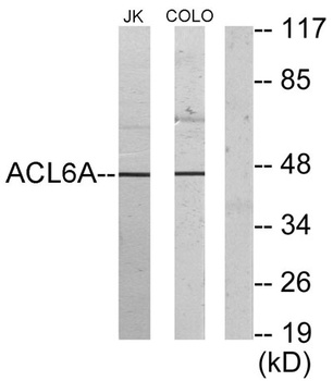 BAF53 rabbit pAb Antibody