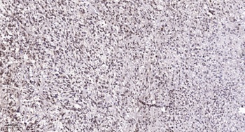 BAF53 rabbit pAb Antibody