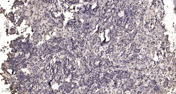 KLF7 rabbit pAb Antibody