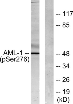 RUNX1 (phospho Ser249) rabbit pAb Antibody