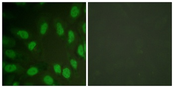 RUNX1 rabbit pAb Antibody