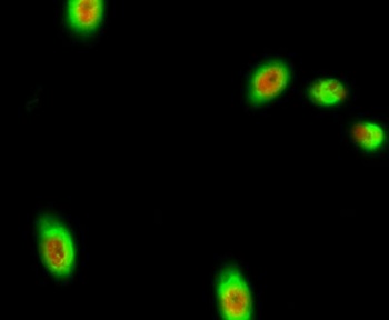 p63 rabbit pAb Antibody