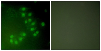 p63 rabbit pAb Antibody