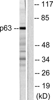 p63 rabbit pAb Antibody