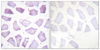 PEA-15 (phospho Ser116) rabbit pAb