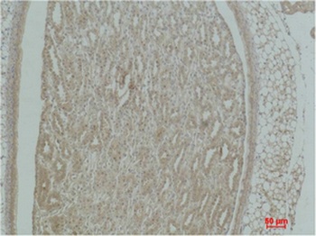 Actinin-α1 rabbit pAb Antibody