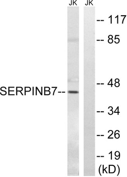 Megsin rabbit pAb Antibody