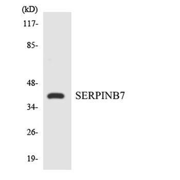 Megsin rabbit pAb Antibody