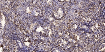 SNX4 rabbit pAb Antibody